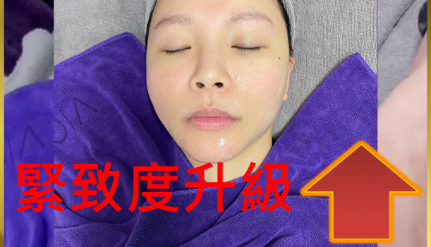 4D黃金膠原蛋白線