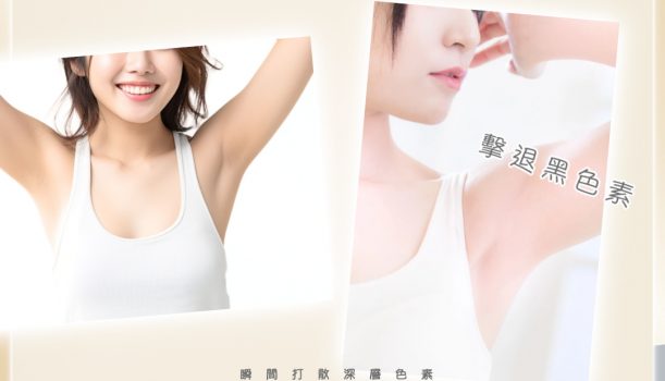 激光美白