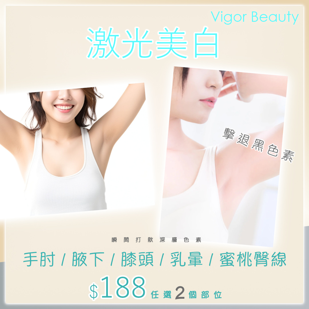 激光美白